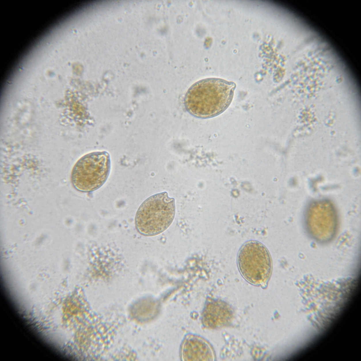 Large-cell Amphidinium microscope view