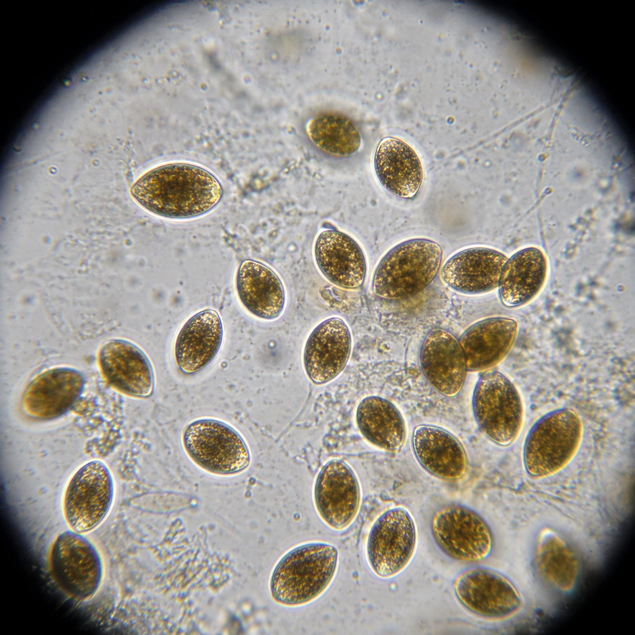 Ostreopsis microscope view