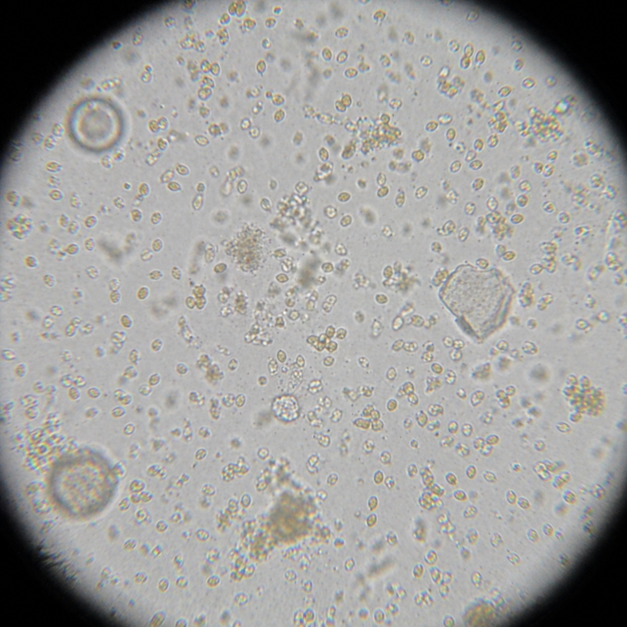 Small-cell Amphidinium microscope view