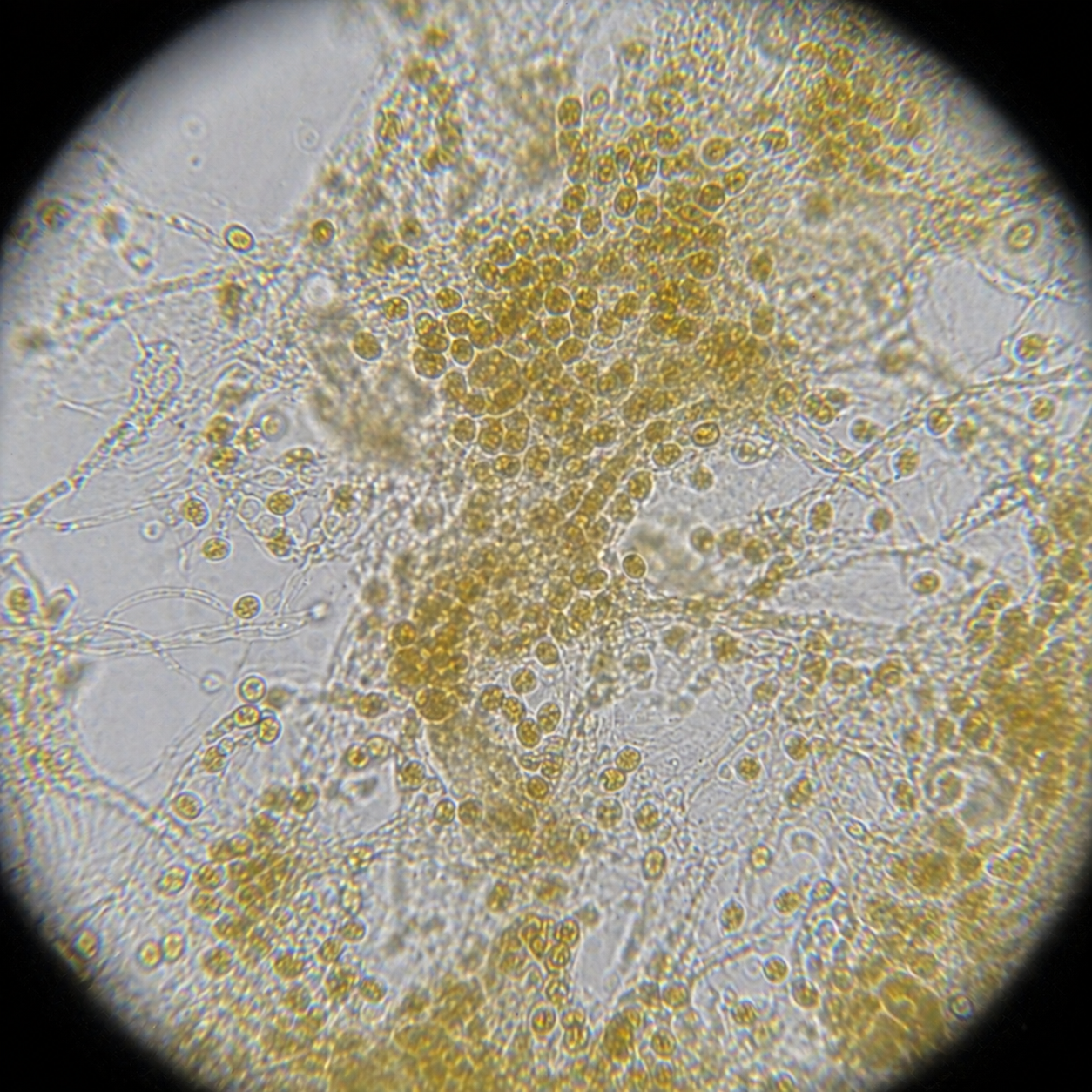 Chrysophytes microscope view