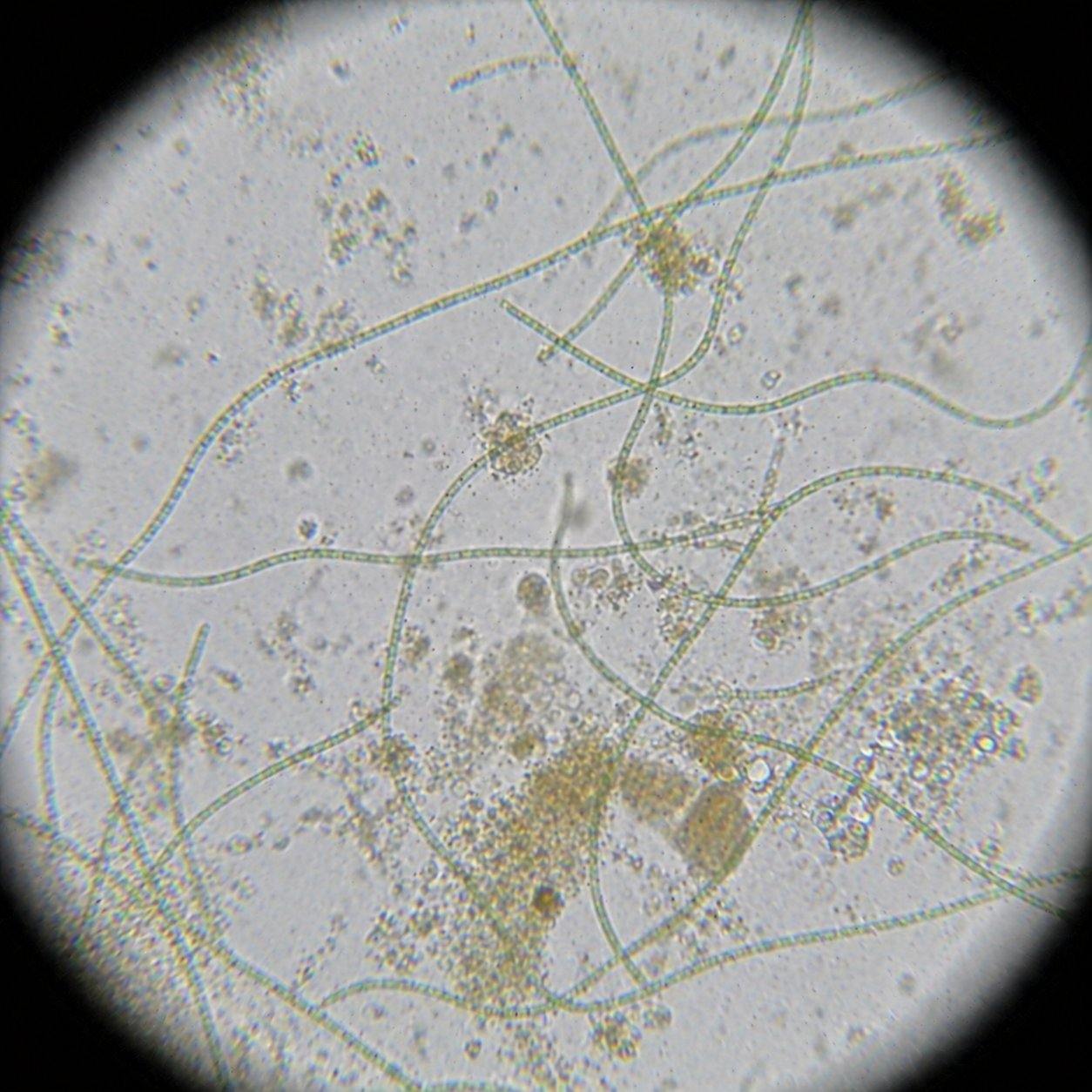 Cyanobacteria microscope view